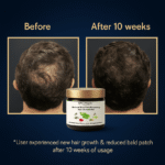 Hair Growth Gel Final Amazon 3-min-min