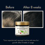 Hair Growth Gel Final Amazon 4-min-min