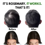 Rosemary oil before and after results showing significant hair growth and reduction of thinning hair spots.