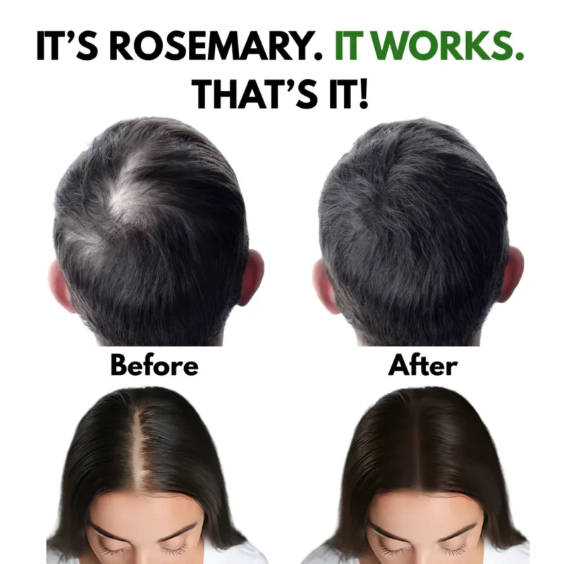 Rosemary oil before and after results showing significant hair growth and reduction of thinning hair spots.