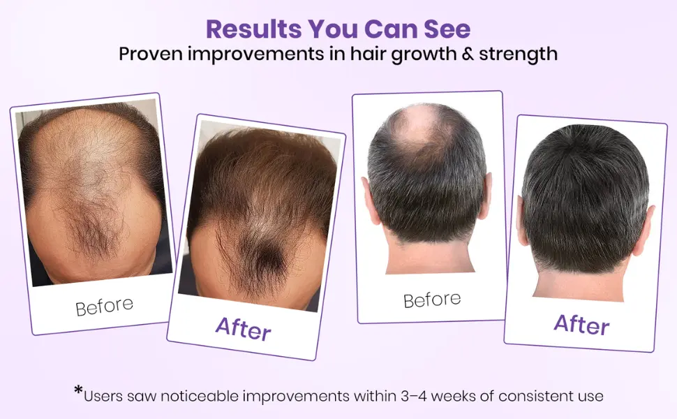 Results after consistent use of rosemary essential oil